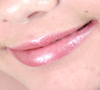 anofen