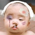 nhim_xu_bong